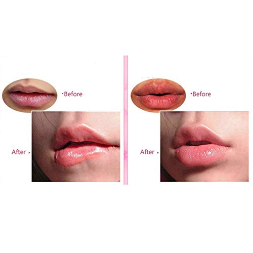 יופי שפתיים מסכות 20-חבילה קולגן קריסטל ג ' ל שפתיים טיפול מסכת לחות לחות מהות,להסיר עור מת, אנטי סדוק,נגד